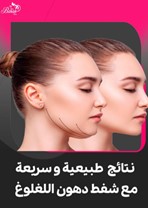 شفط دهون اللقلوق: الحل الأمثل لإبراز جمال الوجه