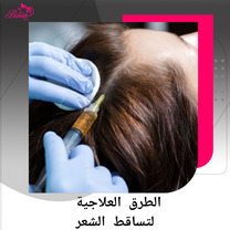 علاج تساقط الشعر وتكثيفه بأحدث الطرق غير الجراحية