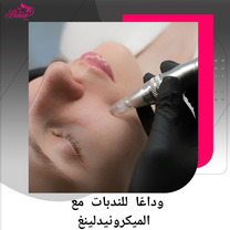 الميكرونيدلينغ لتجديد البشرة وتحفيز الكولاجين — عيادة باران توس
