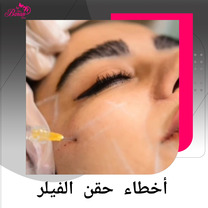حقن الفيلر بأمان: الأخطاء الشائعة وكيفية تجنبها للحصول على نتائج طبيعية