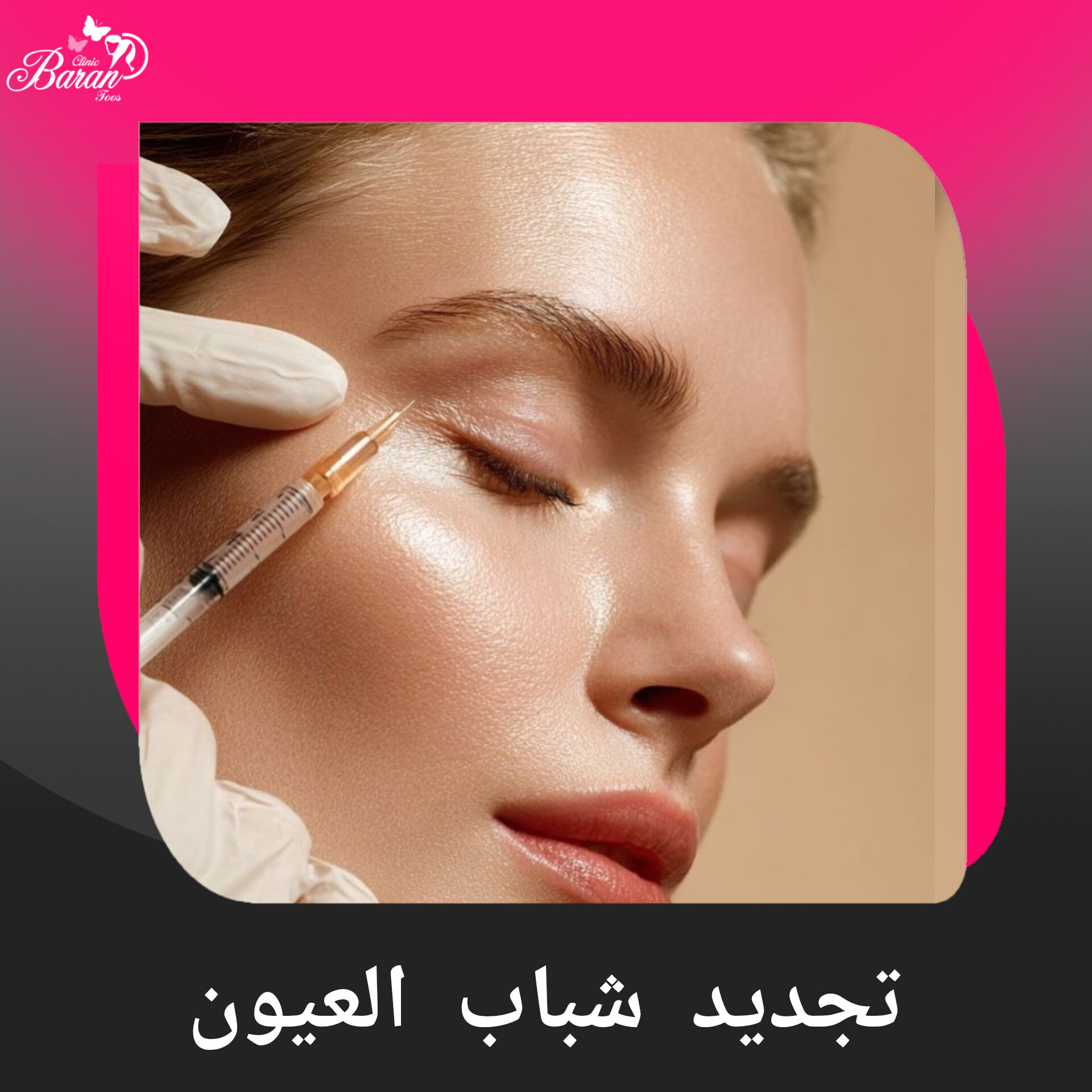 تجديد شباب حول العين
