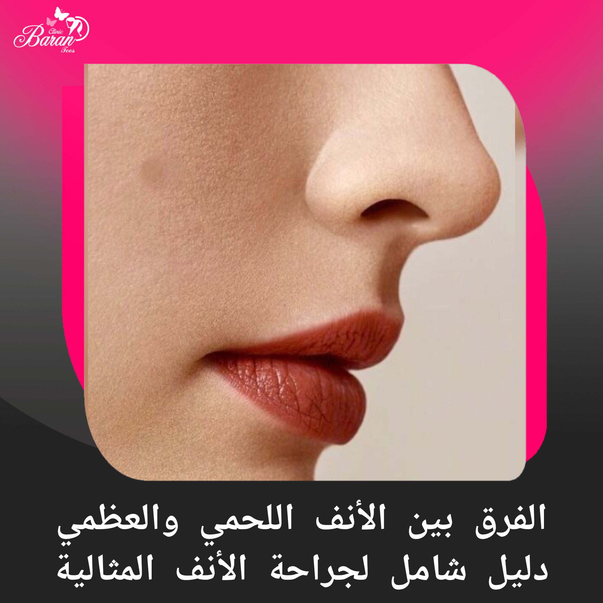 الفرق بين الأنف اللحمي والعظمي: دليل شامل لجراحة الأنف المثالية